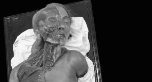 Modelo de cabeza, cuello y parte superior del tórax de una mujer adulta analizada en el estudio. Cuando las donaciones de cadáveres a las facultades de Medicina para que los estudiantes hicieran prácticas de anatomía eran escasas, se empezaron a utilizar a partir del siglo XIX esculturas hiperrealistas de cera sobre una parte ósea real